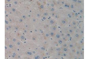 DAB staining on IHC-P; Samples: Human Liver Tissue (CXCL12 anticorps  (AA 23-89))