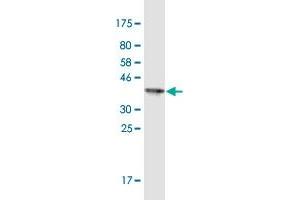 Western Blot detection against Immunogen (37.