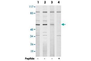 Western blot analysis of extracts from HeLa cells (Lane 1), HUVEC cells (Lane 2) and Jurkat cells (Lane 3 and lane 4), using TBX15/TBX18 polyclonal antibody . (T-Box 15 anticorps)
