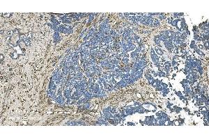 IHC analysis of GNG2 using anti-GNG2 antibody (ABIN7600505).
