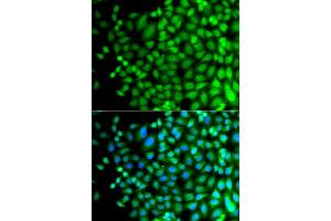 Immunofluorescence analysis of A549 cells using SUPT20H antibody (ABIN5975125). (FAM48A/P38IP anticorps)