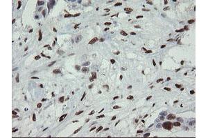Image no. 1 for anti-Transcription Factor MafB (MAFB) (AA 32-320) antibody (ABIN1491411) (MAFB anticorps  (AA 32-320))