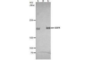 IP Image EGFR antibody [C2C3], C-term immunoprecipitates EGFR protein in IP experiments. (EGFR anticorps  (C-Term))