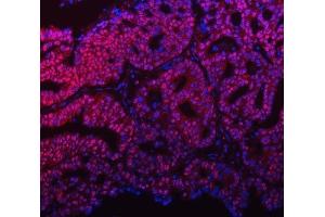 IF analysis of mSin3A/SIN3A using anti-mSin3A/SIN3A antibody (ABIN7602504). (SIN3A anticorps  (AA 8-918))