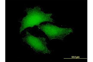Immunofluorescence of purified MaxPab antibody to NF2 on HeLa cell.