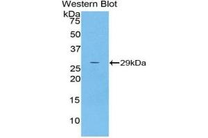 Detection of Recombinant a2ML1, Human using Polyclonal Antibody to Alpha-2-Macroglobulin Like Protein 1 (a2ML1) (A2ML1 anticorps  (AA 1119-1348))