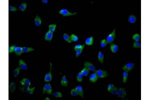 Immunofluorescence staining of SH-SY5Y cells with ABIN7170283 at 1:166, counter-stained with DAPI.
