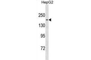TTBK1 Antibody (Center) (ABIN1881954 and ABIN2838922) western blot analysis in HepG2 cell line lysates (35 μg/lane). (TTBK1 anticorps  (AA 667-695))
