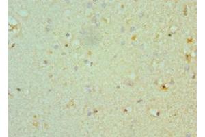 Immunohistochemistry of paraffin-embedded human brain tissue using ABIN7160351 at dilution of 1:100