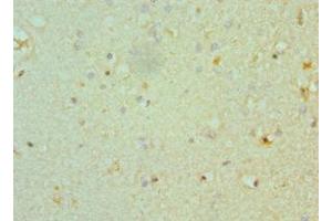 Immunohistochemistry of paraffin-embedded human brain tissue using ABIN7160351 at dilution of 1:100 (CHRM3 anticorps  (AA 270-470))