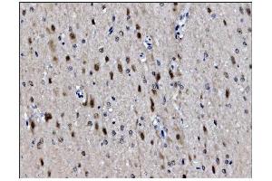 IHC analysis of JAB1 using anti-JAB1 antibody (ABIN7602482). (COPS5 anticorps  (AA 8-334))