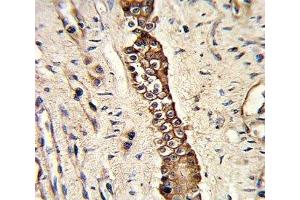 IHC analysis of FFPE human normal lung with DDR2 antibody