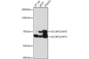 Western blot analysis of extracts of various cell lines, using IGF2BP2/IGF2BP2/IMP2 Rabbit mAb (ABIN7267903) at 1:1000 dilution. (IGF2BP2 anticorps)