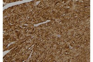 ABIN6268928 at 1/100 staining Rat heart tissue by IHC-P.