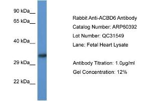 Western Blotting (WB) image for anti-Acyl-CoA Binding Domain Containing 6 (ACBD6) (Middle Region) antibody (ABIN2788432) (ACBD6 anticorps  (Middle Region))