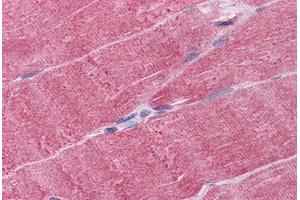 Human Skeletal muscle: Formalin-Fixed, Paraffin-Embedded (FFPE) (WDR77 anticorps  (AA 1-343))