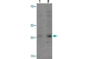Western blot analysis of VNN3 in human brain tissue with VNN3 polyclonal antibody  at (1) 0. (VNN3 anticorps  (C-Term))