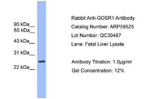 WB Suggested Anti-GOSR1  Antibody Titration: 0. (GS28 anticorps  (C-Term))