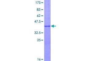 Image no. 1 for Melan A (MLANA) (AA 1-118) protein (GST tag) (ABIN1310996)