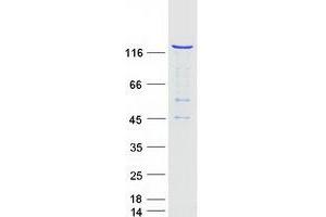 Validation with Western Blot