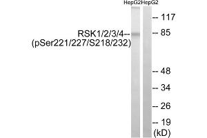 Western blot analysis of extracts from HepG2 cells, treated with EGF (200ng/ml, 30mins), using RSK1/2/3/4 (Phospho-Ser221/227/218/232) antibody. (RSK1/2/3/4 (pSer218), (pSer22), (pSer227), (pSer232) anticorps)