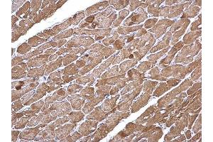 IHC-P Image alpha Cardiac Muscle Actin antibody detects alpha Cardiac Muscle Actin protein at cytoplasm on mouse heart by immunohistochemical analysis. (ACTC1 anticorps)
