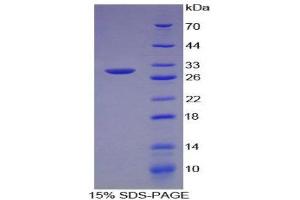 SDS-PAGE (SDS) image for Intelectin 1 (Galactofuranose Binding) (ITLN1) (AA 31-253) protein (His tag) (ABIN1879060)