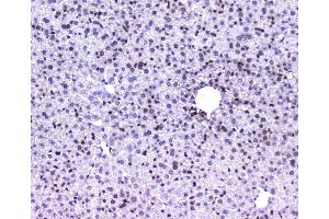 IHC analysis of AHR using anti-AHR antibody (ABIN6719265).