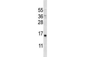 PTH antibody western blot analysis in MDA-MB231 lysate. (PTH anticorps  (AA 59-88))