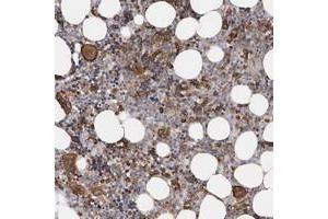 Immunohistochemical staining of human bone marrow with TIMM17B polyclonal antibody  shows strong cytoplasmic positivity in bone marrow poietic cells. (TIMM17B anticorps)