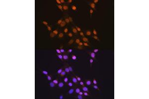 Immunofluorescence analysis of NIH-3T3 cells using CTCF antibody (ABIN7266164). (CTCF anticorps)