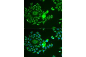 Immunofluorescence analysis of U2OS cells using NDUFS4 antibody. (NDUFS4 anticorps)