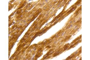 Immunohistochemistry of paraffin-embedded mouse heart using PRKCA antibody (ABIN4904772) at dilution of 1:100 (40x lens). (PKC alpha anticorps)
