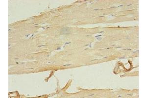 Immunohistochemistry of paraffin-embedded human skeletal muscle tissue using ABIN7158082 at dilution of 1:100