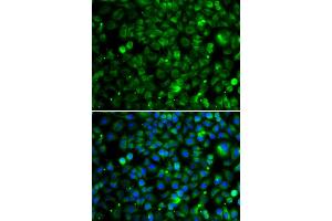 Immunofluorescence analysis of MCF-7 cells using TMLHE antibody.