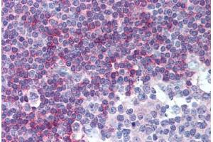 Human Tonsil (formalin-fixed, paraffin-embedded) stained with TNFRSF13C antibody ABIN239855 at 10 µg/ml followed by biotinylated anti-mouse IgG secondary antibody ABIN481714, alkaline phosphatase-streptavidin and chromogen. (TNFRSF13C anticorps)