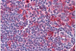 Human Tonsil: Formalin-Fixed, Paraffin-Embedded (FFPE)