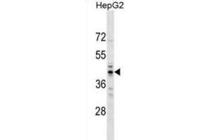 Western Blotting (WB) image for anti-RNA (Guanine-9-) Methyltransferase Domain Containing 2 (RG9MTD2) antibody (ABIN2999749) (RG9MTD2 anticorps)