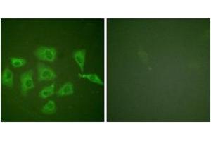 Immunofluorescence analysis of HuvEc cells, using Trk A (Ab-791) Antibody. (TRKA anticorps  (AA 747-796))