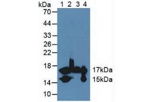 Figure. (FABP4 anticorps  (AA 2-132))