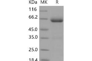 Western Blotting (WB) image for Programmed Cell Death 1 Ligand 2 (PDCD1LG2) (Active) protein (Fc Tag) (ABIN7197486) (PDCD1LG2 Protein (Fc Tag))