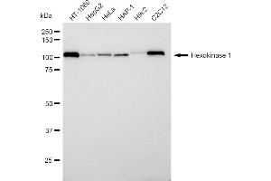 Western blotting analysis using Hexokinase 1 antibody (ABIN7798906).