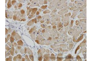 Image no. 1 for anti-Acyl-CoA Dehydrogenase, Very Long Chain (ACADVL) (AA 345-435) antibody (ABIN598520) (ACADVL anticorps  (AA 345-435))