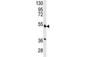 Western blot analysis of HNF4A antibody and NCI-H460 lysate.