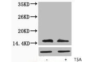 Western blot analysis of extracts from Hela cells, untreated (-) or treated, 1:5000. (H2AFX anticorps  (acLys5))