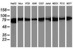 Image no. 2 for anti-Catenin (Cadherin-Associated Protein), beta 1, 88kDa (CTNNB1) antibody (ABIN1496892) (CTNNB1 anticorps)