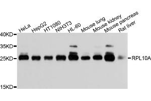 Western blot analysis of extracts of various cell lines, using RPL10A antibody (ABIN5973518) at 1/1000 dilution. (RPL10A anticorps)