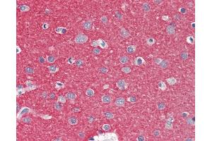 Anti-ZMYND15 antibody IHC staining of human brain, cortex. (ZMYND15 anticorps  (AA 137-186))