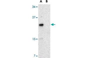 Western blot analysis of NKIRAS2 in Raw 264. (NKIRAS2 anticorps  (C-Term))