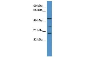 WB Suggested Anti-B3galt2 Antibody Titration:  0.
